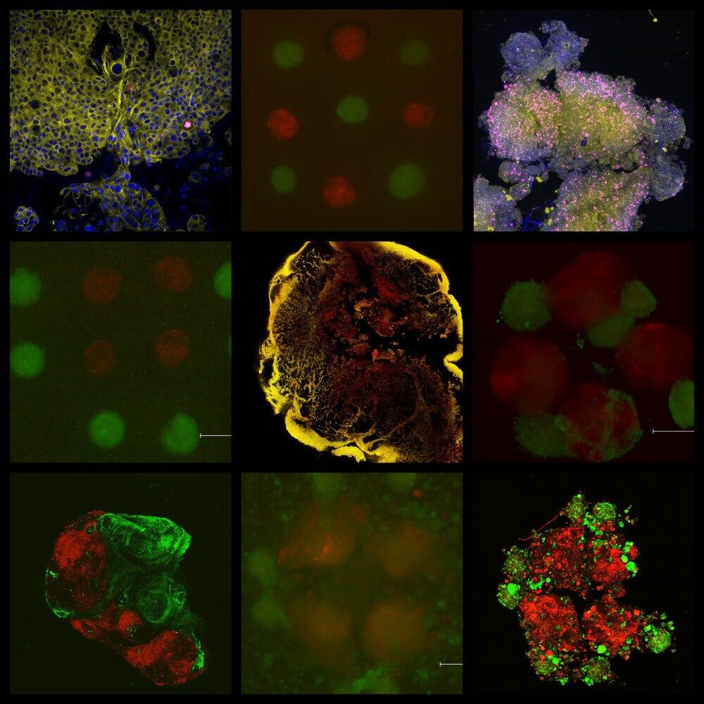 Scientists of NUST MISIS have 3D-printed a model of a cancer tumor